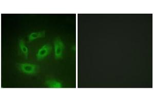 Immunofluorescence analysis of HeLa cells, using TGF beta Receptor I (epitope around residue 165) antibody.