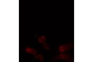 ABIN6276354 staining  Hela cells by IF/ICC. (ABL1 anticorps  (N-Term))