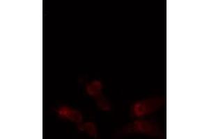 ABIN6276354 staining  Hela cells by IF/ICC.