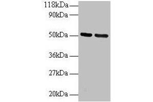 Western blot All lanes: GDI2 antibody at 2 μg/mL Lane 1: 293T whole cell lysate Lane 2: EC109 whole cell lysate Secondary Goat polyclonal to rabbit IgG at 1/15000 dilution Predicted band size: 51, 46 kDa Observed band size: 51 kDa (GDI2 anticorps  (AA 1-441))