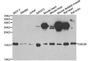 Western blot analysis of extracts of various cell lines, using UBE2B antibody. (UBE2B anticorps  (AA 1-152))