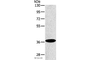 Western blot analysis of Raji cell, using ACMSD Polyclonal Antibody at dilution of 1:400 (ACMSD anticorps)