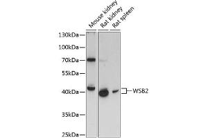 Western blot analysis of extracts of various cell lines, using WSB2 antibody (ABIN6133280, ABIN6150269, ABIN6150270 and ABIN6216800) at 1:3000 dilution.