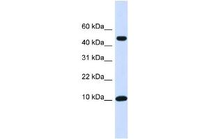 WB Suggested Anti-ZNF706 Antibody Titration:  0. (ZNF706 anticorps  (N-Term))
