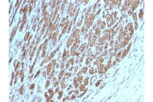 Formalin-fixed, paraffin-embedded human Tonsil stained with Catenin beta Mouse Monoclonal Antibody (CTNNB1/2098).