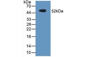 Western blot analysis of recombinant Mouse MUC1. (MUC1 anticorps  (AA 474-630))