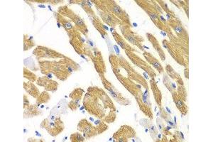 Immunohistochemistry of paraffin-embedded Mouse heart using AIMP1 Polyclonal Antibody at dilution of 1:100 (40x lens). (AIMP1 anticorps)