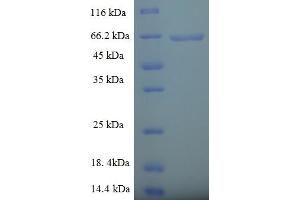 SDS-PAGE (SDS) image for Phospholipase D4 (PLD4) (AA 52-506), (partial) protein (His-SUMO Tag) (ABIN5711579)