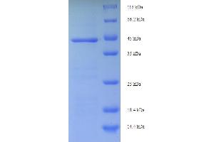 SDS-PAGE (SDS) image for Receptor (TNFRSF)-Interacting serine-threonine Kinase 1 (RIPK1) (AA 1-257), (full length) protein (His-SUMO Tag) (ABIN5710700)