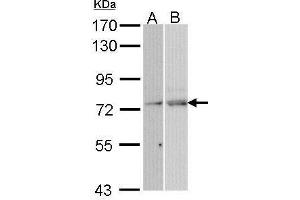 Western blot analysis of 30 ug of whole cell lysate (A: Hela; B: Molt-4) using a 7. (NXF1 anticorps)