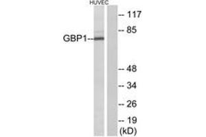 Western blot analysis of extracts from HuvEc cells, using GBP1 Antibody. (GBP1 anticorps  (AA 71-120))