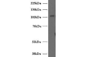 ABIN2563976 (2µg/ml) staining of Human T-lymphocyte lysate (35µg protein in RIPA buffer). (UNC13D anticorps  (Internal Region))
