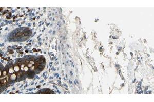 ABIN6267367 at 1/100 staining Mouse intestine tissue by IHC-P.