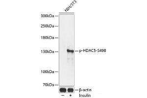 Western blot analysis of extracts of NIH/3T3 cells using Phospho-HDAC5(S498) Polyclonal Antibody at dilution of 1:2000. (HDAC5 anticorps  (pSer498))