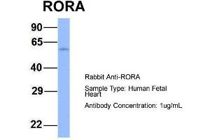 Host:  Rabbit  Target Name:  RORA  Sample Type:  Human Fetal Heart  Antibody Dilution:  1. (RORA anticorps  (N-Term))