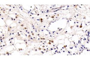 Detection of TLR5 in Rat Lung Tissue using Monoclonal Antibody to Toll Like Receptor 5 (TLR5)