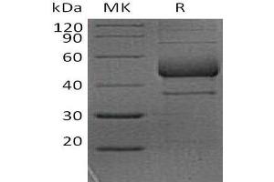 Western Blotting (WB) image for Inducible T-Cell Co-Stimulator (ICOS) protein (Fc Tag) (ABIN7321000)