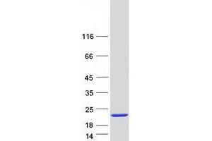 Validation with Western Blot
