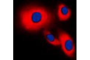 Immunofluorescent analysis of CDC25B staining in THP1 cells.