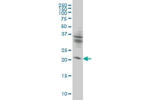KIF26A monoclonal antibody (M01), clone 3C10 Western Blot analysis of KIF26A expression in HeLa . (KIF26A anticorps  (AA 1-203))