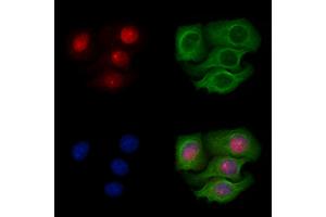 ABIN6256382 and ABIN6267095 staining Heat-shock treated Hela cells by IF/ICC.