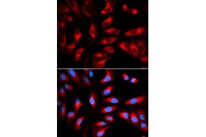 Immunofluorescence analysis of U2OS cell using DNM1L antibody.