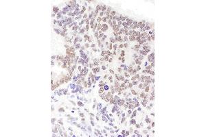 Immunohistochemistry (IHC) image for anti-serine/arginine-Rich Splicing Factor 6 (SRSF6) (AA 250-300) antibody (ABIN7454941)