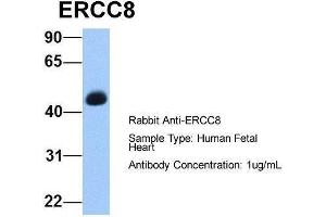 Host:  Rabbit  Target Name:  ERCC8  Sample Type:  Human Fetal Heart  Antibody Dilution:  1. (ERCC8 anticorps  (C-Term))