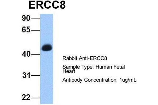 ERCC8 anticorps  (C-Term)