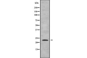 Western blot analysis of Rho G using Jurkat whole cell lysates (RHOG anticorps  (Internal Region))