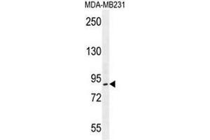 PCAF Antibody (N-term) western blot analysis in MDA-MB231 cell line lysates (35µg/lane). (KAT2B anticorps  (N-Term))