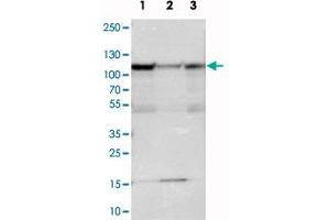 Western blot analysis of cell lysates with SMEK1 polyclonal antibody . (SMEK1 anticorps)