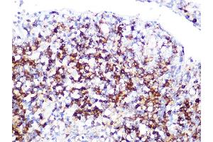 Immunohistochemistry of paraffin-embedded human appendix using LDHB Rabbit mAb (ABIN7268170) at dilution of 1:100 (40x lens). (LDHB anticorps)