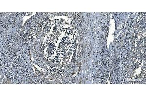 IHC analysis of MCU using anti-MCU antibody (ABIN7601931). (MCU anticorps  (AA 51-351))