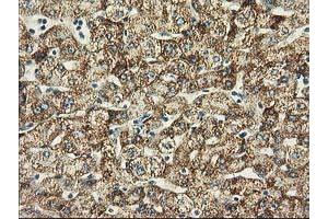 Immunohistochemical staining of paraffin-embedded Human liver tissue using anti-BECN1 mouse monoclonal antibody. (Beclin 1 anticorps)