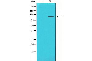 Western blot analysis on LOVO cell lysate using FGFR3 Antibody,The lane on the left is treated with the antigen-specific peptide. (FGFR3 anticorps  (C-Term))