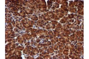 Image no. 6 for anti-Histidyl-tRNA Synthetase 2, Mitochondrial (Putative) (HARS2) antibody (ABIN1498584)