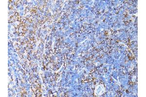 Immunohistochemistry of paraffin-embedded mouse liver using β-actin antibody. (beta Actin anticorps)