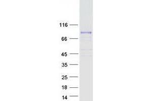 Validation with Western Blot