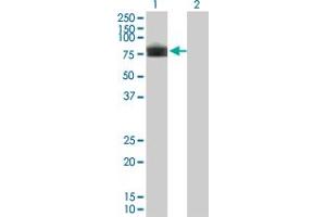 Western Blot analysis of PLXDC1 expression in transfected 293T cell line by PLXDC1 monoclonal antibody (M01), clone 4B10. (PLXDC1 anticorps  (AA 313-421))