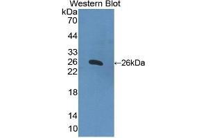 Western Blotting (WB) image for anti-Apolipoprotein B (APOB) antibody (FITC) (ABIN1862186) (APOB anticorps  (FITC))