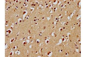 IHC image of ABIN7139932 diluted at 1:100 and staining in paraffin-embedded human brain tissue performed on a Leica BondTM system. (UBE2M anticorps  (AA 11-28))