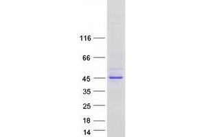 Validation with Western Blot
