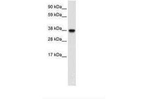 Image no. 1 for anti-N-Myc (And STAT) Interactor (NMI) (AA 66-115) antibody (ABIN202210)