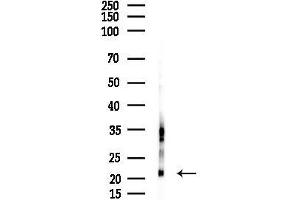 anti-Glutathione Peroxidase 7 (GPX7) (Internal Region) antibody
