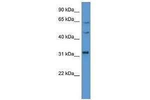 Western Blot showing MKNK1 antibody used at a concentration of 1-2 ug/ml to detect its target protein. (MKNK1 anticorps  (C-Term))