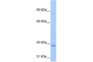 NSUN3 antibody used at 0. (NSUN3 anticorps  (C-Term))