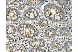 IHC analysis of ME2 using anti-ME2 antibody (ABIN7600967). (NAD-ME anticorps  (AA 26-584))