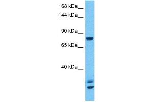 Host:  Rabbit  Target Name:  CSF3R  Sample Type:  293T Whole Cell lysates  Antibody Dilution:  1ug/ml (CSF3R anticorps  (N-Term))