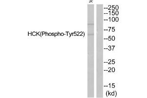 Western blot analysis of extracts from JurKat cells using HCK (Phospho-Tyr522) Antibody.
